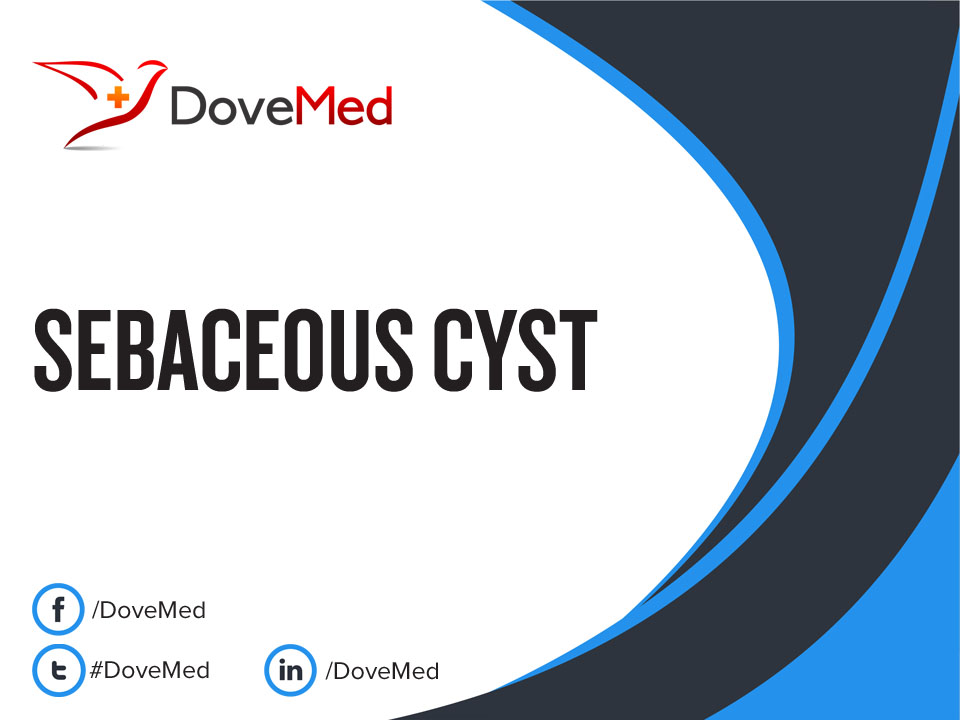 Sebaceous Cyst