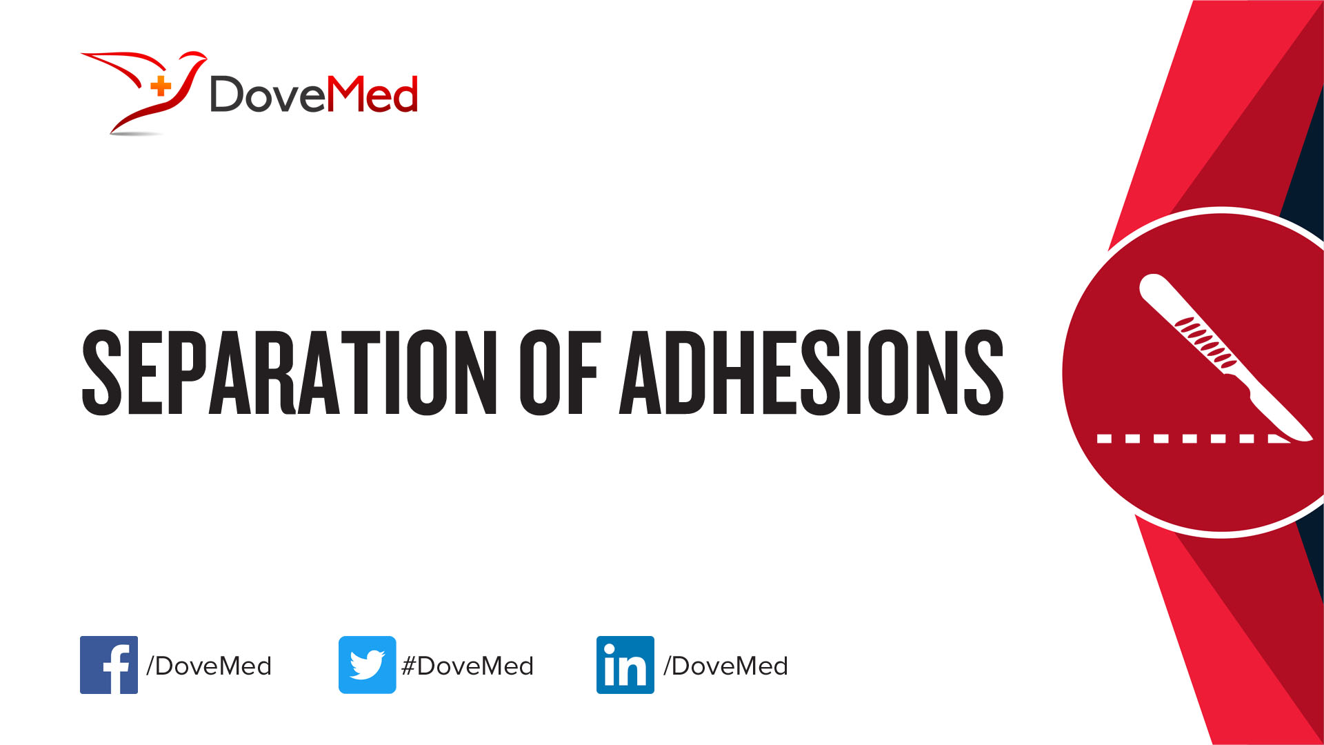 separation-of-lysis-of-adhesions