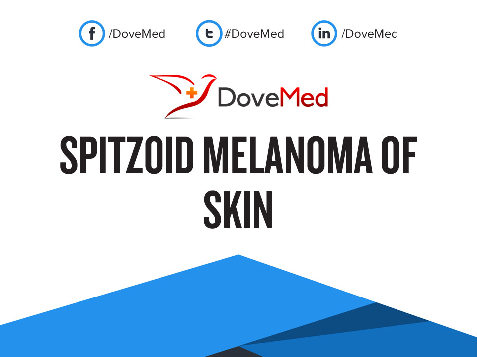 what is spitz melanoma