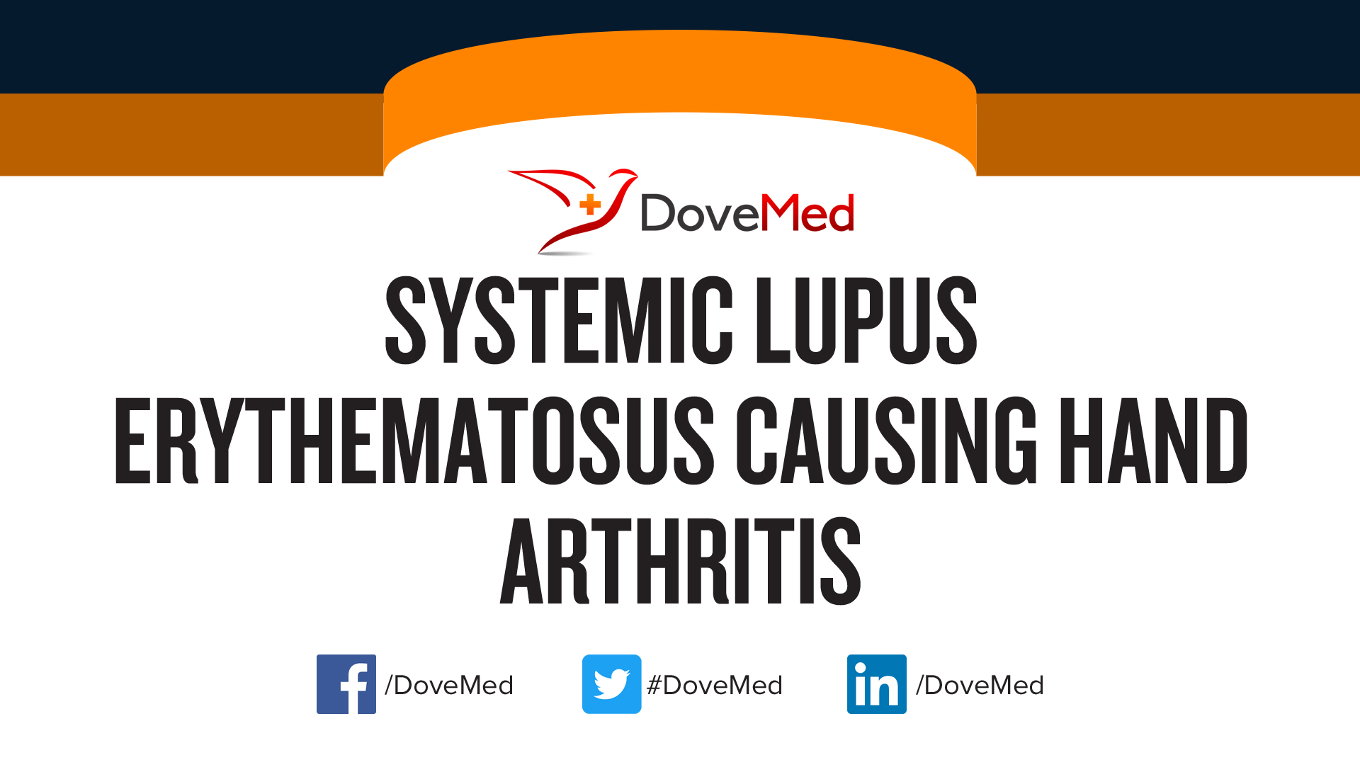 Systemic Lupus Erythematosus causing Hand Arthritis