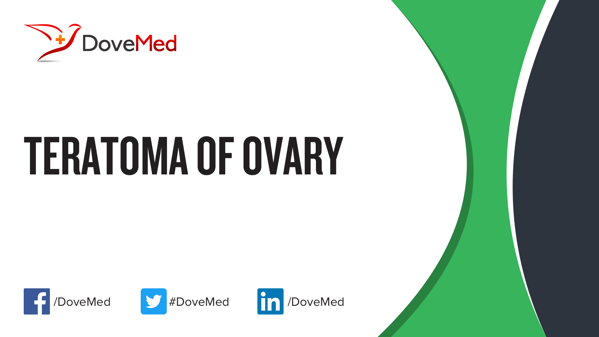 teratoma-of-ovary