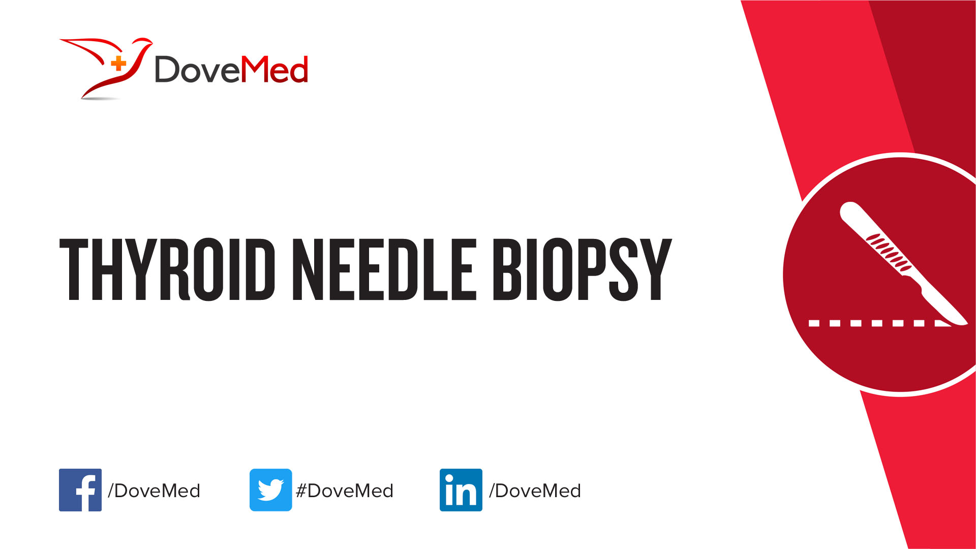 thyroid-needle-biopsy