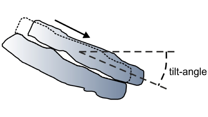 Tilt Table Testing