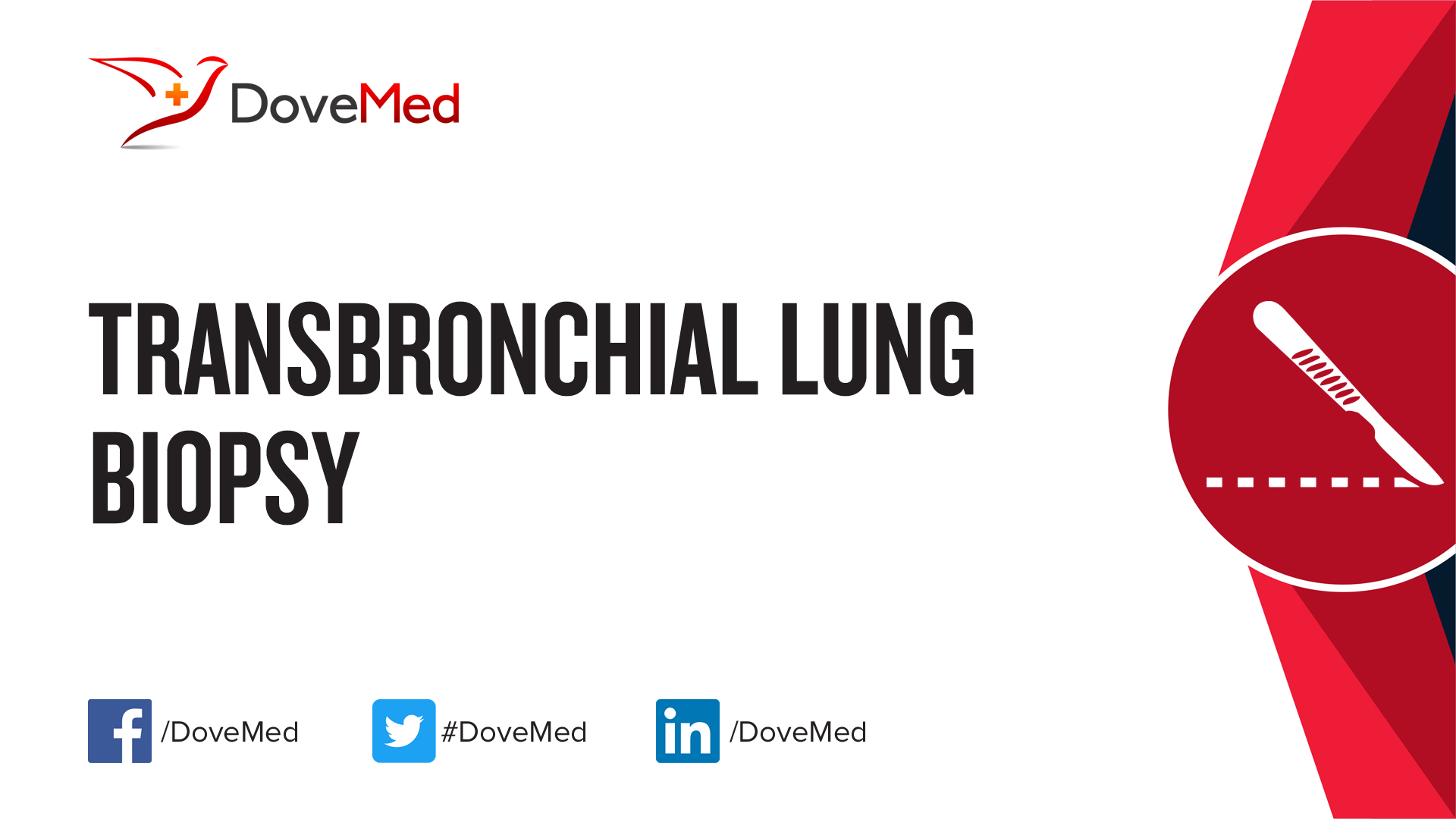 transbronchial-lung-biopsy