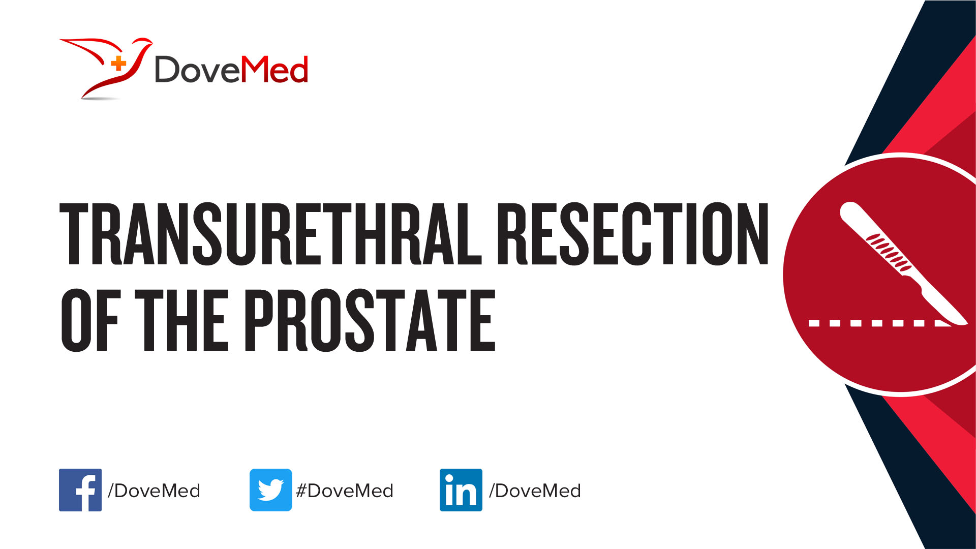 Transurethral Resection Of The Prostate Turp 0883