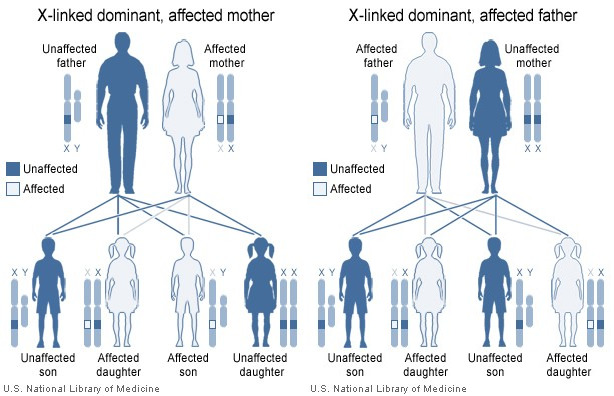 Familial Hypophosphatemia