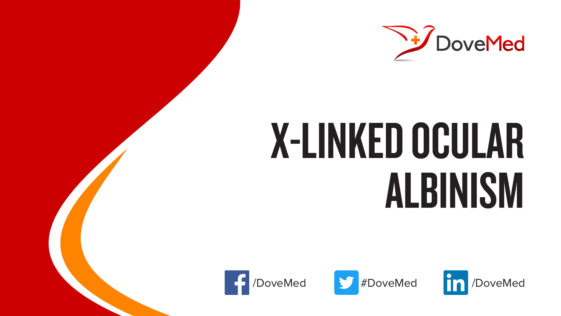 x-linked-ocular-albinism-xloa