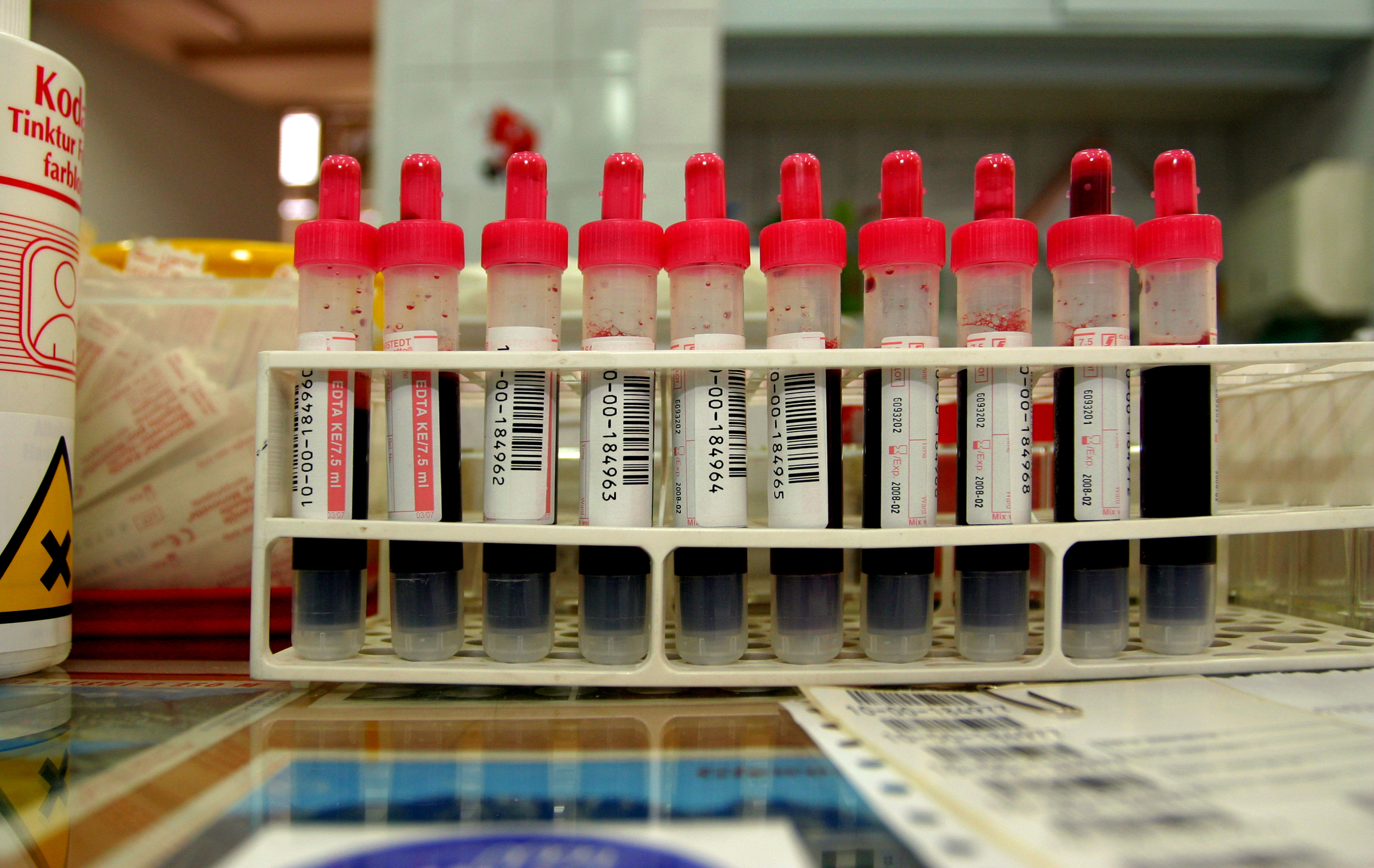 Comprehensive Metabolic Panel Blood Test